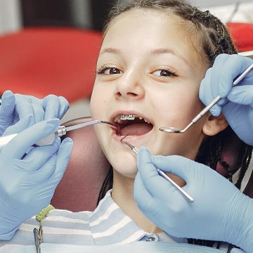 5 Tips To Help Overcome Fear Of Dentists