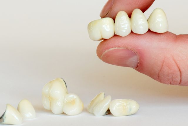 Pediatric Crown Aftercare