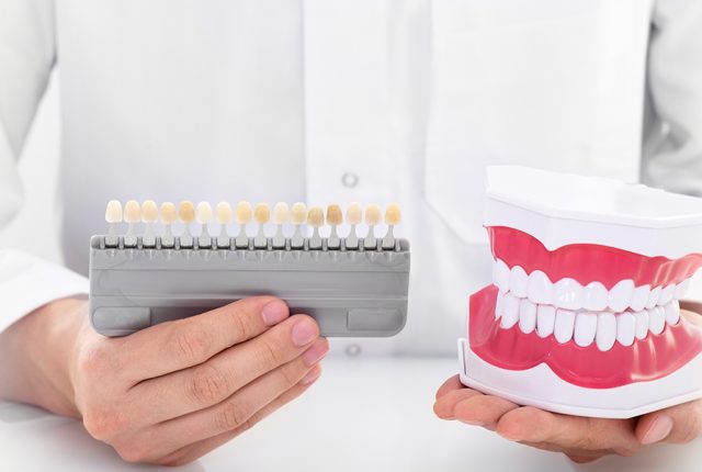 VENEERS 3