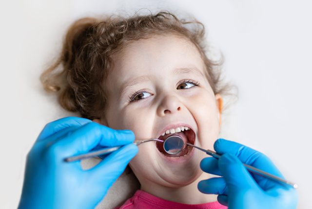 What Are Dental Crowns and Why Are They Needed