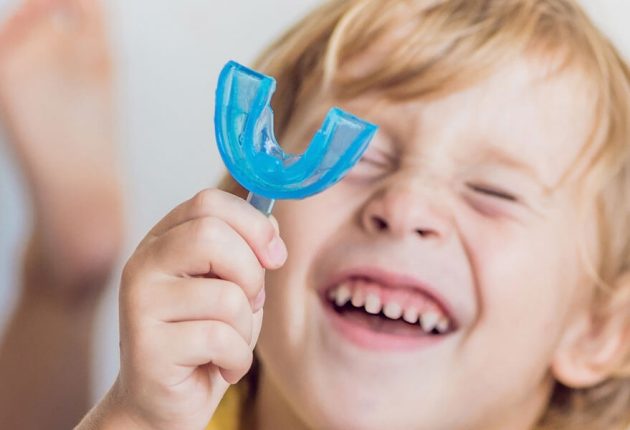 mouthguards
